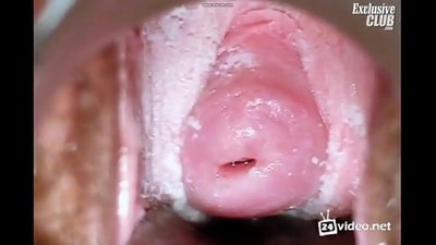 Pemeriksaan ginekologi seorang wanita cantik